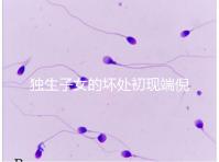 獨生子女的壞處初現端倪，贍養父母已成難題