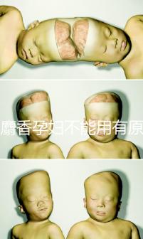 白麝香孕婦不能用有原因,流產(chǎn)、早產(chǎn)…這些危害不得不知