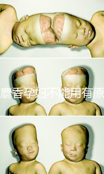 白麝香孕婦不能用有原因,流產(chǎn)、早產(chǎn)…這些危害不得不知