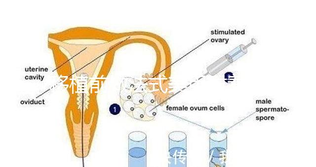 移植前做法式美甲對著床影響不少，別以為貼甲片就沒事了