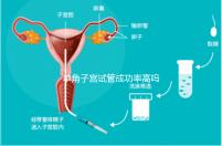 單角子宮試管成功率高嗎?送你5招降低胚胎著床的難度