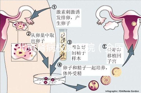 北京腎病權威醫(yī)院(全國腎病醫(yī)院排名一)