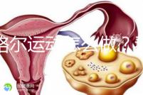 凱格爾運動怎么做?看看專業(yè)老師分享的分步驟圖解