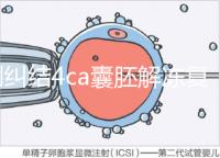 別糾結4ca囊胚解凍復蘇最早幾天能測出了，著床率先了解下