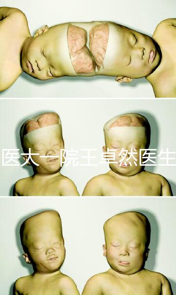 哈醫大一院王卓然醫生試管攻略,坐診時間、成功率早知道