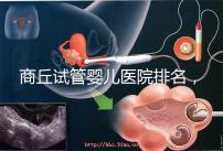 商丘試管嬰兒醫院排名，附3家公立機構助孕成功率和費用