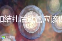告知結(jié)扎后試管應(yīng)該做什么準(zhǔn)備,是否有照片檢查,有答案