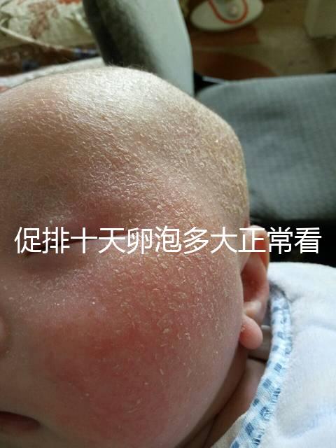 促排十天卵泡多大正?？催@，1.1×0.9符不符合一文說清