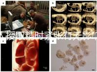 人授取精時緊張有無影響別還不造,注意事項不少不可不知