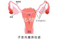 產(chǎn)后喝生化湯排惡露會(huì)使寶寶拉肚子?醫(yī)生:時(shí)間沒用對(duì)