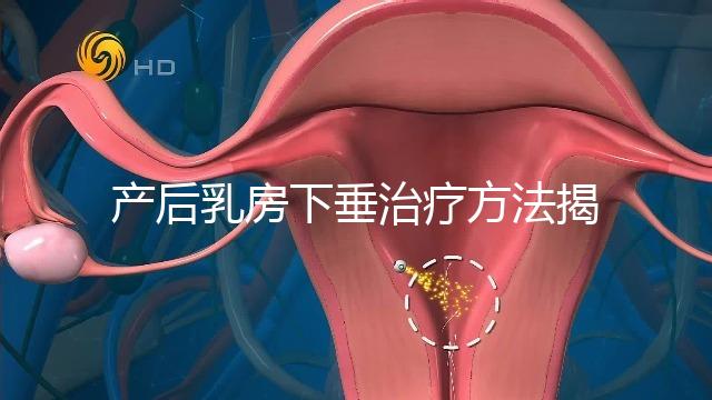 產后乳房下垂治療方法揭秘，按摩手法再好也沒提前預防有用