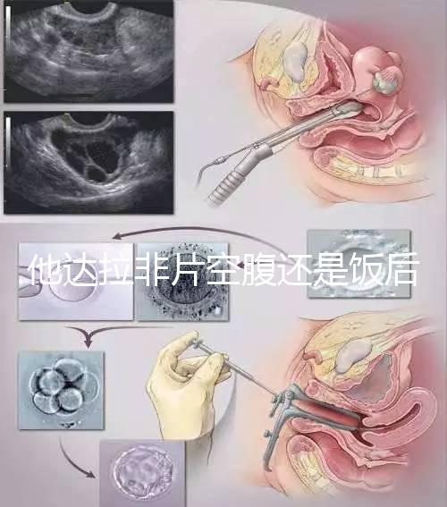 他達(dá)拉非片空腹還是飯后吃看這，控制好用藥時間效果佳