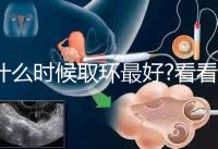 什么時候取環(huán)最好?看看各地姐妹們有什么經(jīng)驗之談