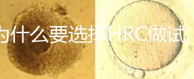 為什么要選擇HRC做試管？這6大優(yōu)勢看完就知道答案