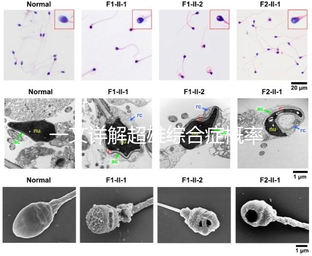 一文詳解超雄綜合癥概率有多大，想造的人多不多看過來