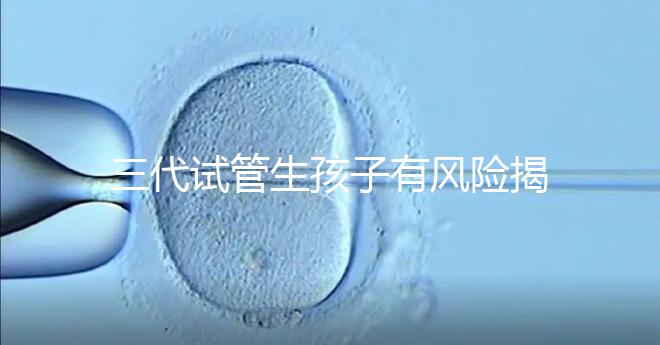三代試管生孩子有風險揭秘嗎?嬰兒會有問題嗎?