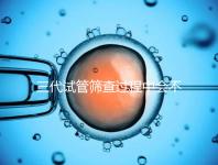 三代試管篩查過程中會不會出現(xiàn)錯誤戳,看完流程就知道