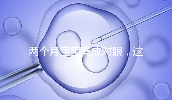 兩個月寶寶竟成對眼，這5大形成原因家長必知