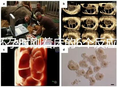 懷孕時(shí)剛著床的6個(gè)反應(yīng)，同房后這個(gè)時(shí)候觀察身體最準(zhǔn)