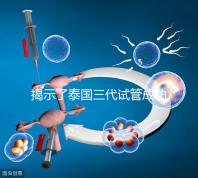 揭示了泰國三代試管成功率高的原因,以及優(yōu)秀的技術(shù) 完美結(jié)合全方位服務(wù)