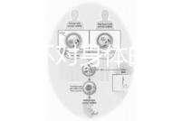 揭秘上環對身體的5大壞處，女人別再無知了