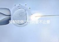 抑郁癥做三代試管不止要基因檢測(cè),這兩大條件也得滿足