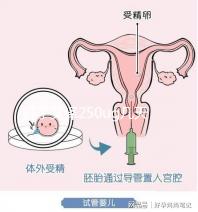 打了艾澤250ug幾天能代謝完戳，第十天別還不敢走下一步