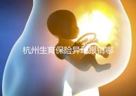 杭州生育保險(xiǎn)異地報(bào)銷哪個部門快拿到?不知道能不能申請引產(chǎn)