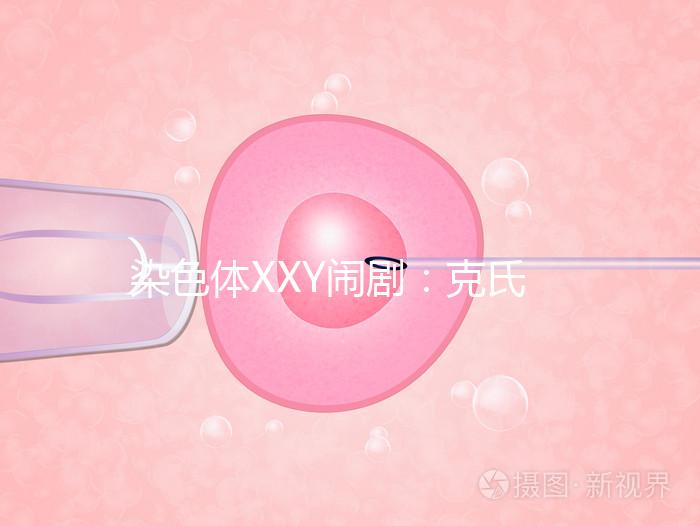 染色體XXY鬧?。嚎耸暇C合征，帶你走進“第三性別”群體