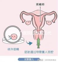 柳州幾個醫院能做第三代試管嬰兒?詳細的費用成功率都在這