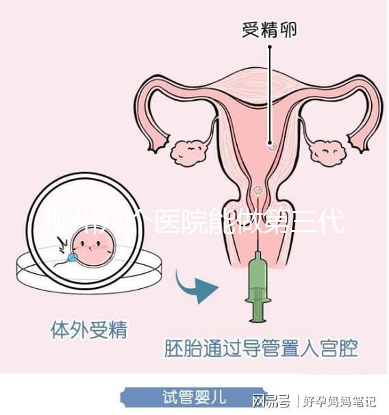 柳州幾個醫(yī)院能做第三代試管嬰兒?詳細的費用成功率都在這