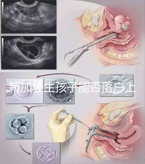 新加坡生孩子能否落戶上海分，@家長:高學歷可以申請
