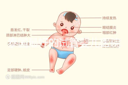 泰國最好的試管嬰兒醫(yī)院(泰國最好的試管嬰兒醫(yī)院是哪個(gè))