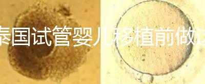 泰國試管嬰兒移植前做這3件事能提高成功率，不然會后悔！