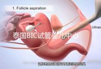 泰國BIC試管嬰兒中心導(dǎo)航，原來跟曼谷醫(yī)院不是一回事兒