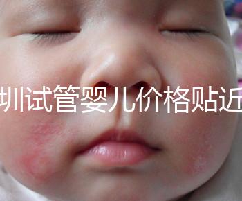 深圳試管嬰兒價格貼近百姓！三代試管只需8