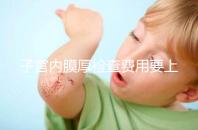 子宮內膜厚檢查費用要上千?那你絕對被忽悠了