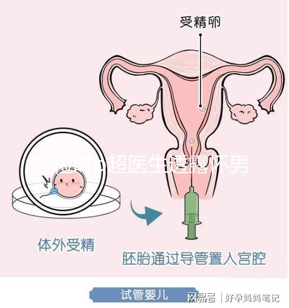 孕檢時(shí)b超醫(yī)生透露懷男寶女寶暗語寶典，一語戳中有心人！