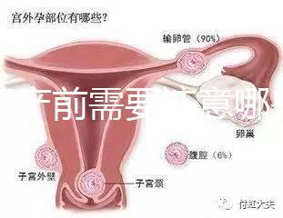 孕婦產前需要注意哪些事項？
