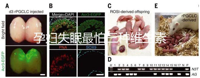 孕婦失眠最怕三種維生素快收藏!B1和B12哪個(gè)好一看便知
