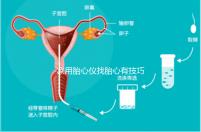 家用胎心儀找胎心有技巧,飯后半個小時測準(zhǔn)確率稍高