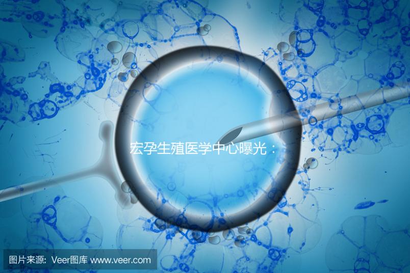 宏孕生殖醫(yī)學中心曝光：PGD成功率及適用人群