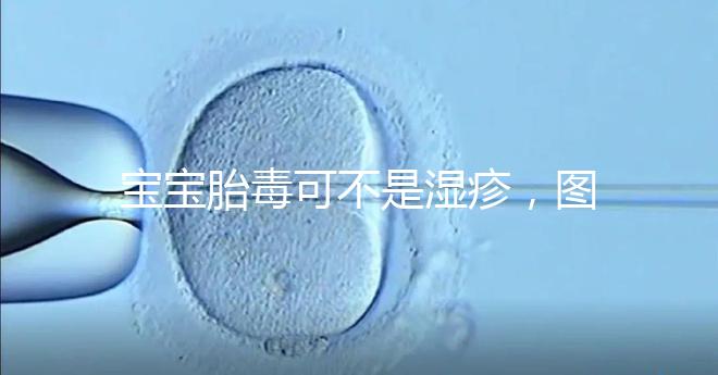 寶寶胎毒可不是濕疹，圖文解讀兩者詳細區別