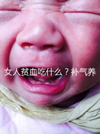 女人貧血吃什么？補(bǔ)氣養(yǎng)血，掌握這五個技巧，讓你煥發(fā)青春光彩