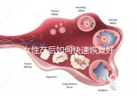 女性產(chǎn)后如何快速恢復(fù)好身材?