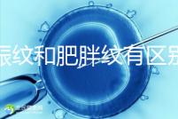 妊娠紋和肥胖紋有區別，教你3種“花紋”診斷鑒別的方法