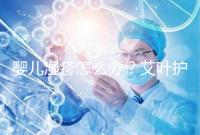 嬰兒濕疹怎么辦？艾葉護理不一定管用，4個小妙招輕松治療