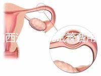 山西汾陽醫院試管費用清單公布,2024年生殖科助孕成功率公布