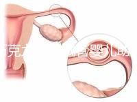 巧克力囊腫試管嬰兒助孕應先治療？網友看法均有差異