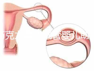巧克力囊腫試管嬰兒助孕應(yīng)先治療？網(wǎng)友看法均有差異